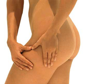 Die Stadien der Cellulite: Kneiftest