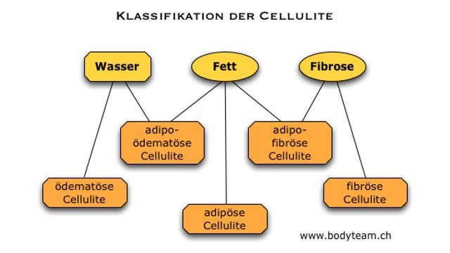 Klassifikation der Cellulite