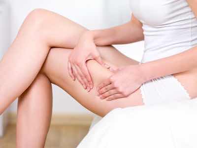 Stadien der Cellulite. Kneiftest